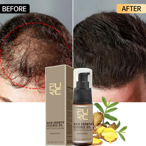 PURC hårväxtolja för män Kvinnor Anti håravfall Hårbottenbehandling Serum Ingefära 7 dagars snabb återväxtvård Hårtillväxtprodukter