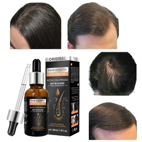 Hårväxt eterisk olja Biotin Kallpressad DHT-blockerare och hårväxtschampo Anti-håravfallsbalsam Massageolja 30ml-3st