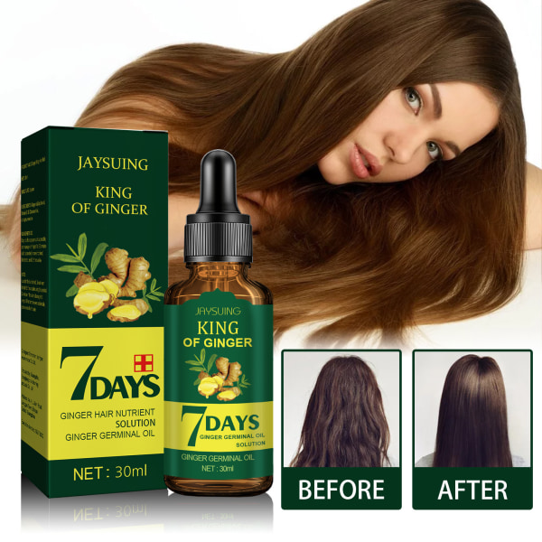 Håravfall och gallringsbehandling, främja tjock hårväxt, förhindra håravfall, 3Cps 30ml-Hårvård-Ginger King Hair Care Oil