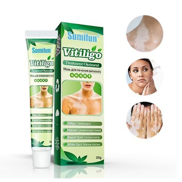White Tag Treatment Moisturizing Cream Reduce White Spots Hud Vitiligo Care 20g