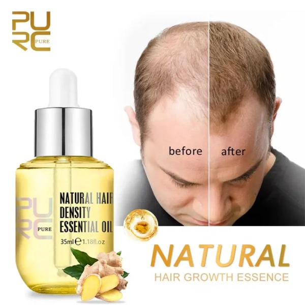 Natural Hair Growth Essence Thickener Återväxt Serum Behandlingar Olja Snabbväxande hår för håravfall Vårdprodukter Män & kvinnor