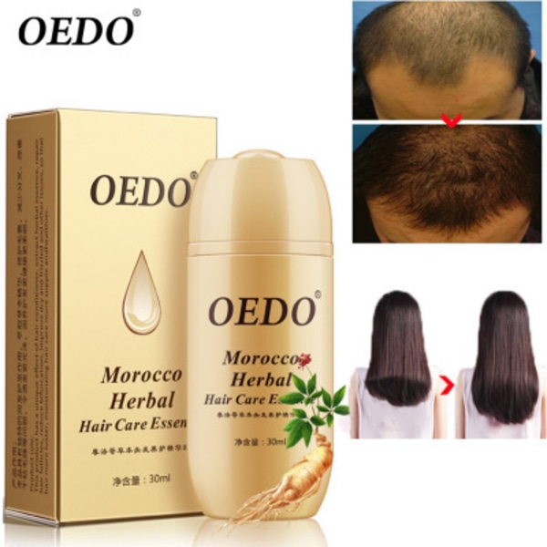 Naturlig ricinolja för torrt skadat hår Förbättra, Arganolja Hårvårdsbehandling, Applicera alla hårtyper Balanserar hårbotten (Marocko)