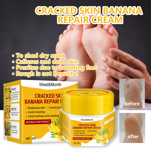 Närande fotkräm (30g) | Bananfot, kräm för hand- och fotreparation, återfuktar och mjukgör nagelbanden, hudkräm, exfolierande näringsrik
