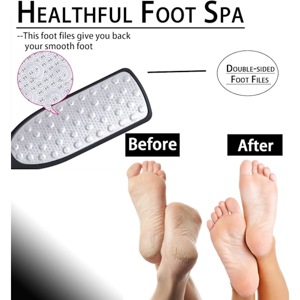 Fodfil til fjernelse af hård hud, 2 i 1 fodskraber til hård hud, fodskrubber, fodskraber i rustfrit stål til pedicure til død hud, hård hud osv.