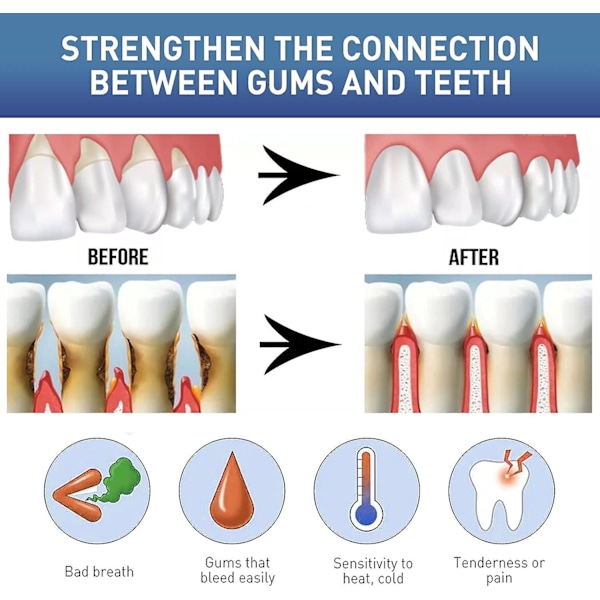 pcs Gum Instant Treatment Gel, gingivaease Gum Pen, Dentizen Gum Therapy Gel, Dentizen Tooth Stain Remover