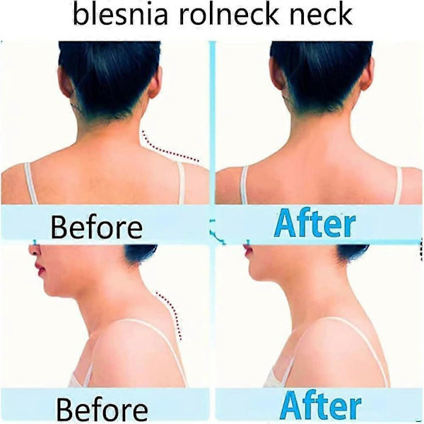 Nakkemassager, Cervical rygmassager, Nakkemassagevalse