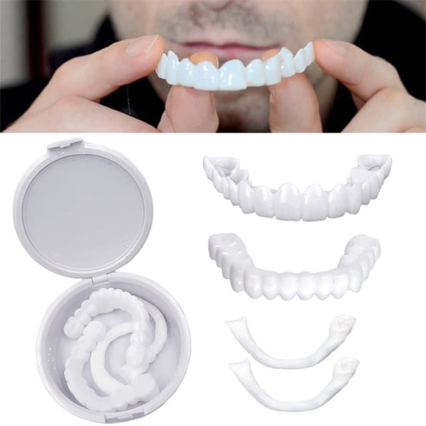 False teeth, dentures for the upper and lower jaw, veneers