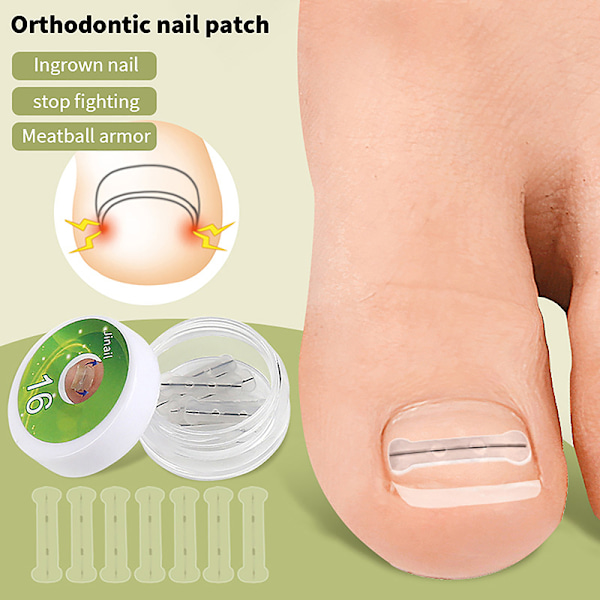 10 st inåtväxta tånagelkorrigering behandling Clip Brace Pedikyr 17MM