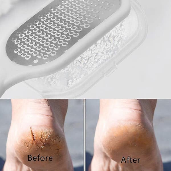 Foot file for removing dead skin and calluses (white)