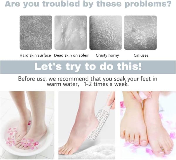 Professional Foot File, Foot Rasp - Double-Sided Foot Rasp