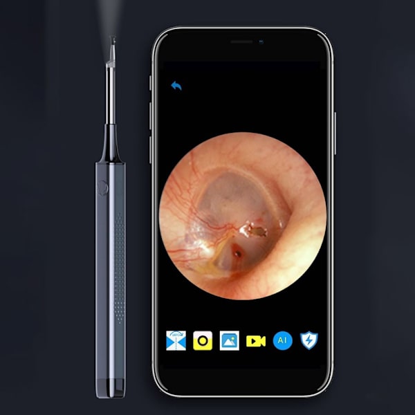Visual Ear Scoop Ear Picking Stick GRÅ grey