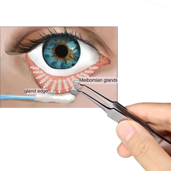 Meibomian Gland Expressor Hierontapinsetit Pihdit