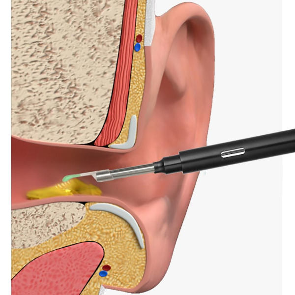 Visual Ear Scoop Øreplukkepind SORT black