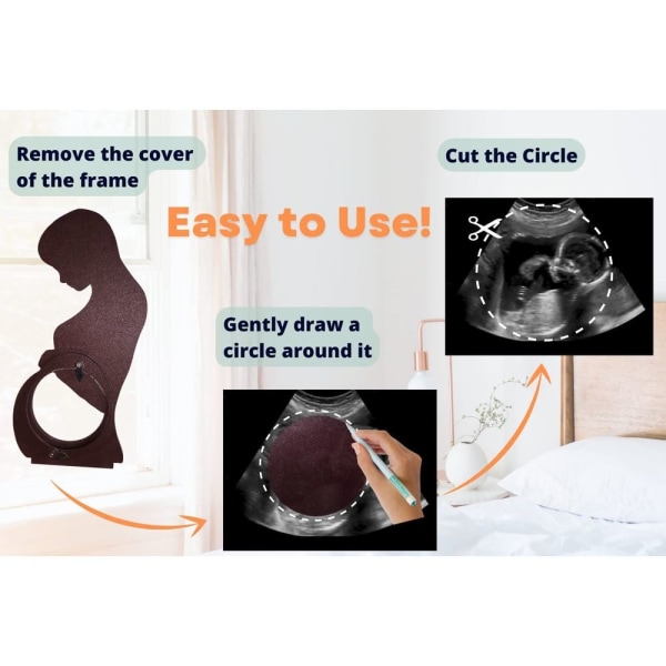 Baby ultralyd fotoramme Sonogram billedramme A A A
