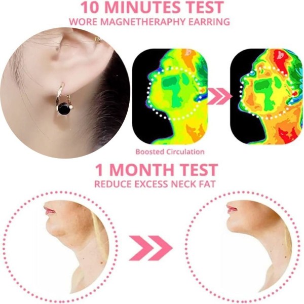 Lymphvity MagneTherapy Germanium Örhängen Lymphvity Magnetic Gold