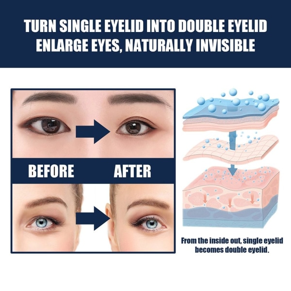Silmäluomen tarra Silmäluomen teippi Kaksinkertainen silmäluomen tahna