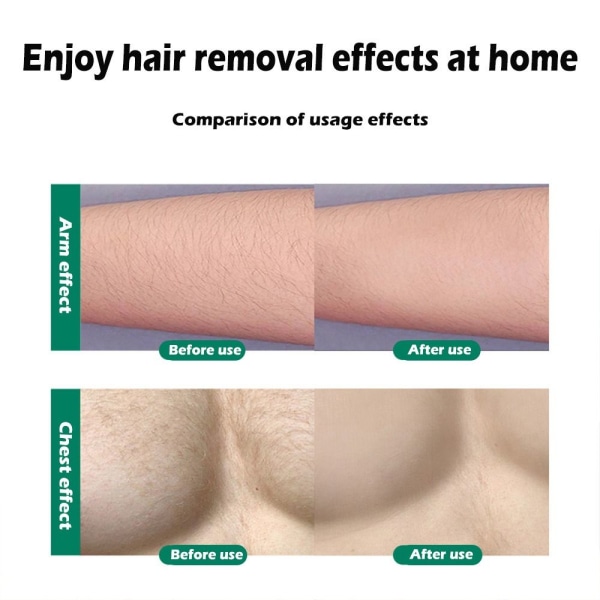 Epilator Hårborttagning för hårborttagning GRÖN green
