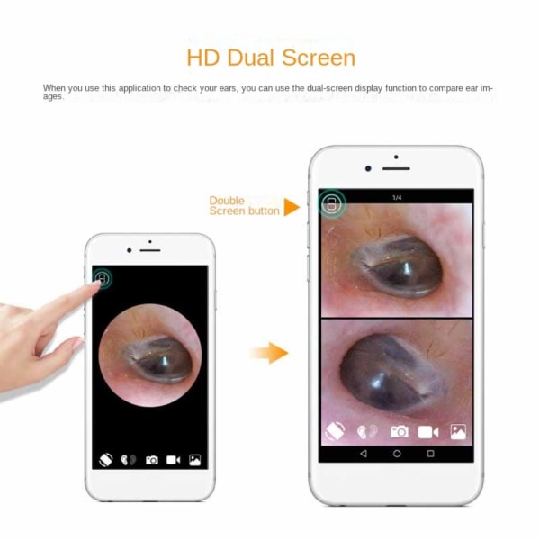 Visuelt digitalt otoskop Øreendoskop Kamera Ørevoksfjerning