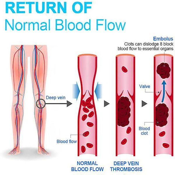 Polvikorkeat reisisukat Ionic Lymphatic Detoxification -sukat MUSTA Black