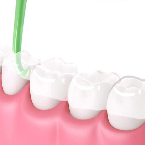 20st Demonteringsverktyg Invisalign Clear aligners för tänder 20PCS