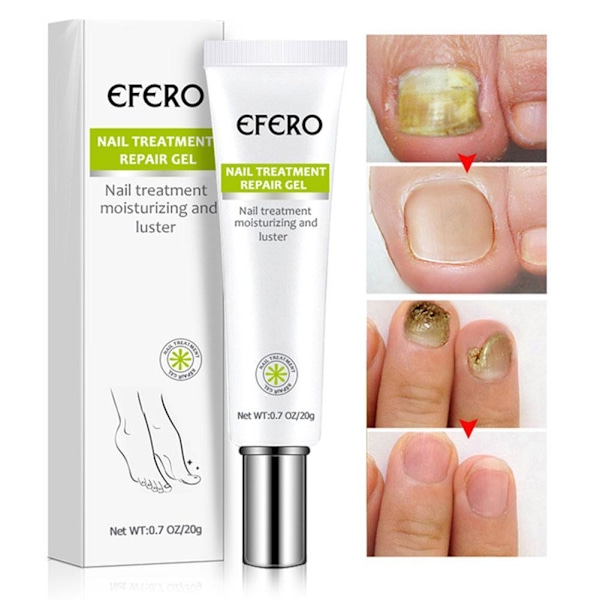 3X EFERO Nagel Anti-Svampinfektion Gelbehandling Hand Fot Kräm