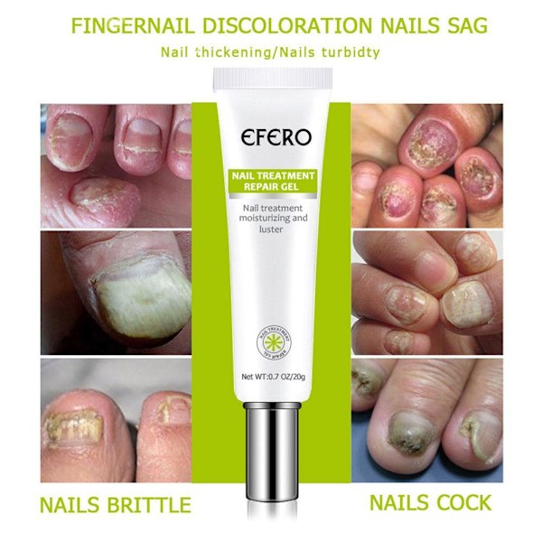 3X EFERO Nagel Anti-Svampinfektion Gelbehandling Hand Fot Kräm