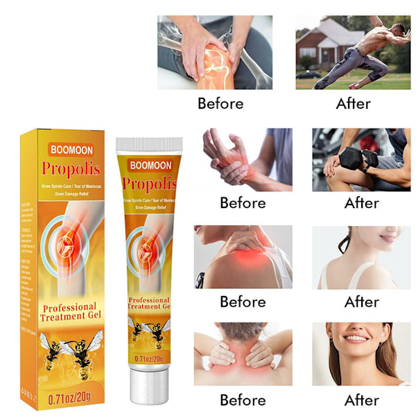1-5X Bi-Gift New Zealand Bi Professionel Behandling Gel Naturli 20gA 1pcs 2pcs