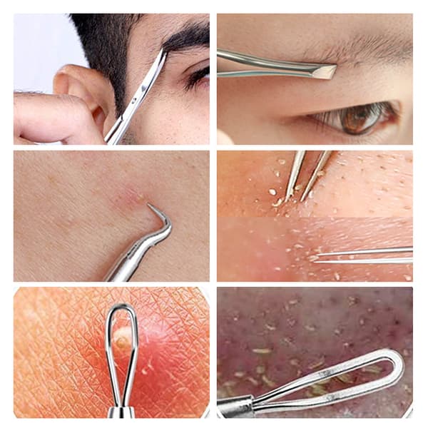 5 Pcs Blackhead Remover Tools Pimple Removal Tool Acne Needles Set Silver