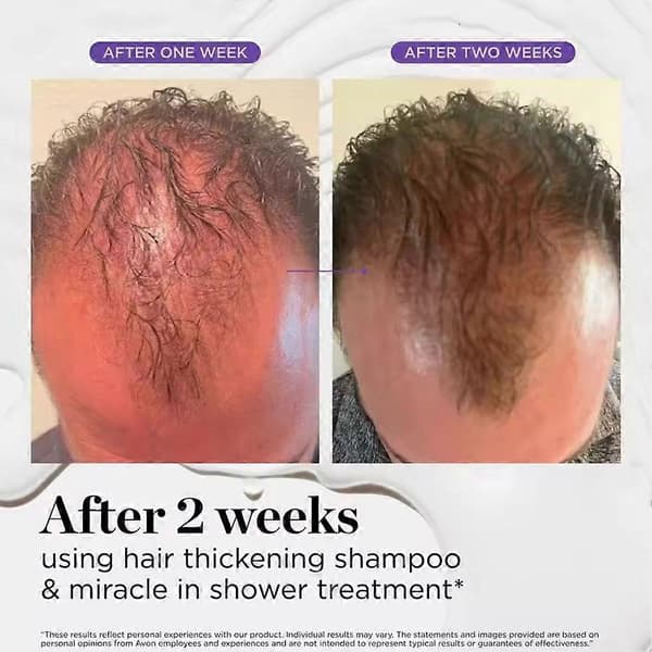 Dr Groot Scalp Revitalizing Solution Hårfortykkende Olie Shampoo Balsam