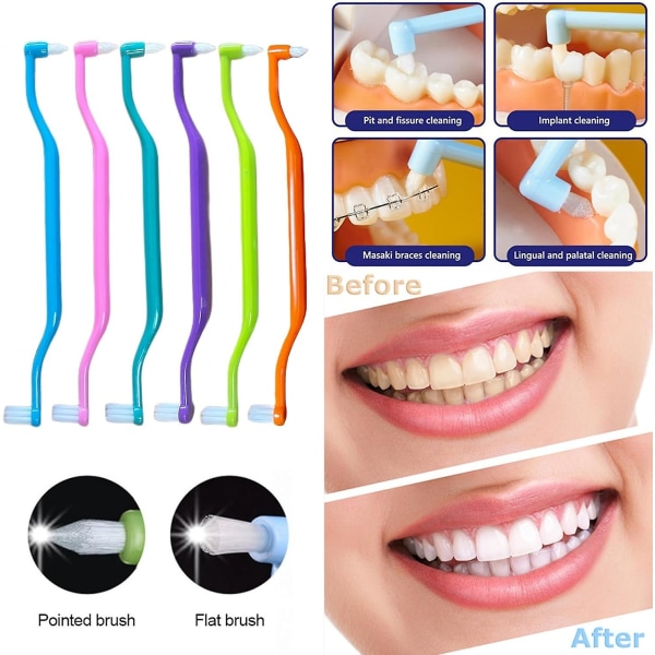 6 stk Interdental-børster, 2-i-1 myk tannbørste med interdental- og visdomstennerbørstehoder for omfattende munnpleie og tannregulering