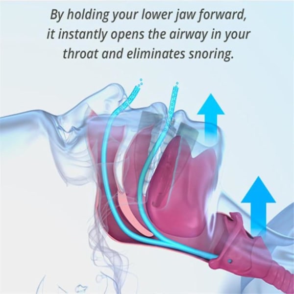 Snore Destroy Tunghållare, Snore Destroy Tunghållare, Tunghållare Snarkning för förbättrad sömnkvalitet 3Pcs