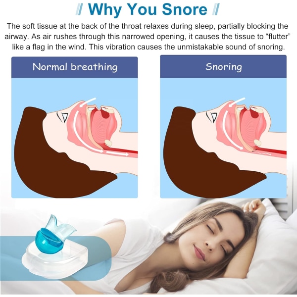 Anti-snorking enheter - Snorking enheter stopper for bedre søvn Stopp snorking, bærbar snorking løsning for menn/kvinner søvn