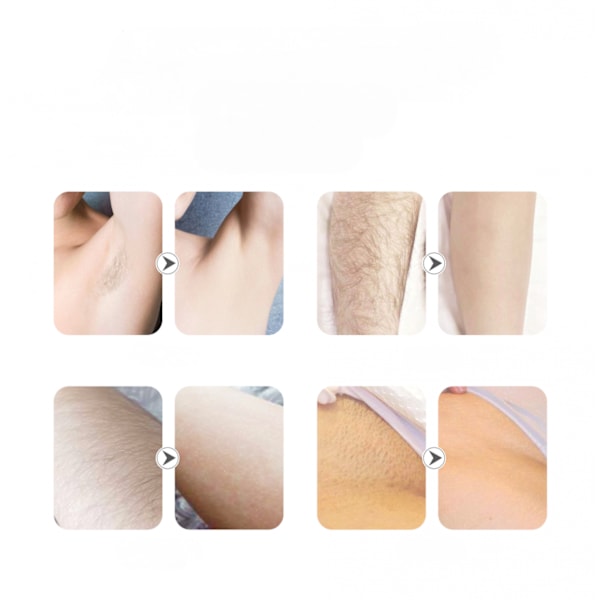 Hårfjernings Epilator til kvinder, trådløs elektrisk pincet, dameepilator, genopladelig hårfjerner til overlæbe og bikinilinje