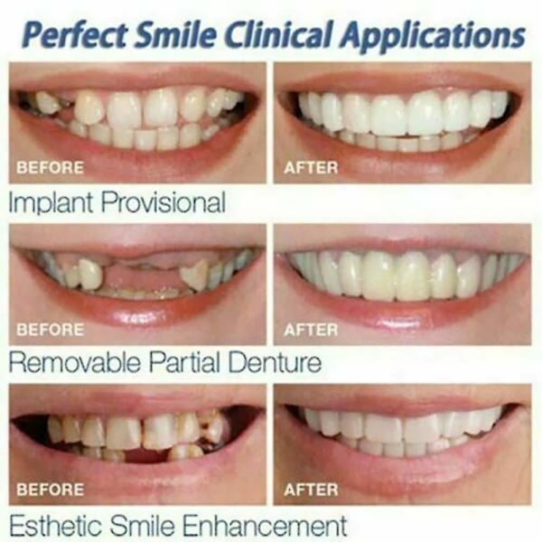 SQBB Perfekt Smil Påsætning Øvre Falske Tænder Dental Veneer Gebis Dæk Sæt null ingen