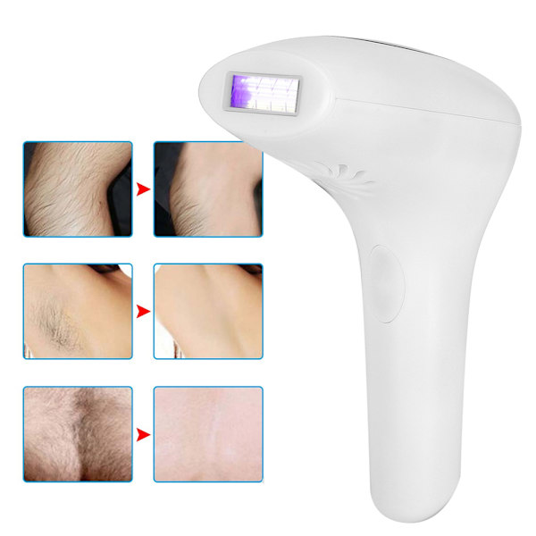 Professionel IPL hårfjernelsesmaskine Elektrisk epilator Depilator Hvid (100‑240V) Pris UE