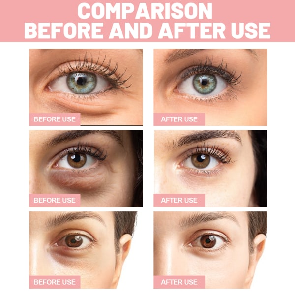 OUHOE Pink Rose Eye Mask minskar fina linjer och mörka cirklar vid ögonvrån Återfuktar och stramar upp huden Ögonvård 60st