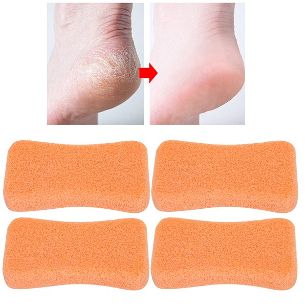 4 st Callus Exfoliate Stone Fötter Skötsel Pimpsten Fötter Hård hud Ta bort Pedikyr ScrubberOrange