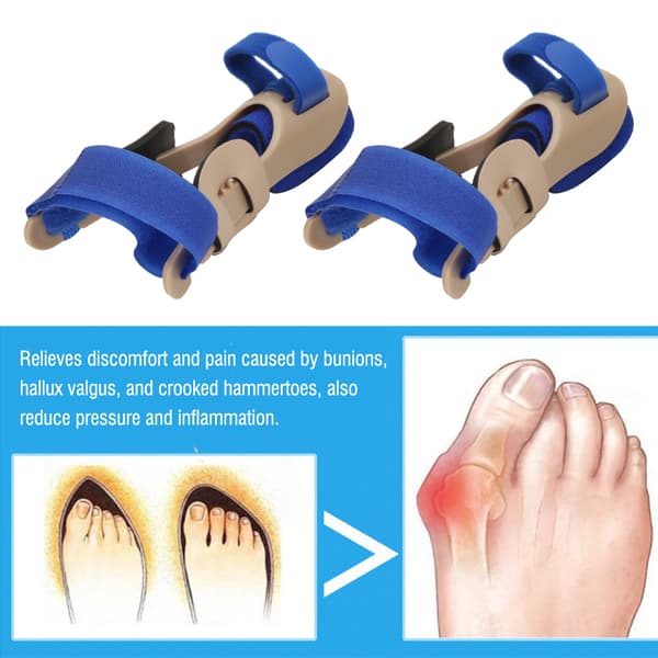 1 par kvinde tåskillere Hallux Valgus knystkorrigerer kan bære sko