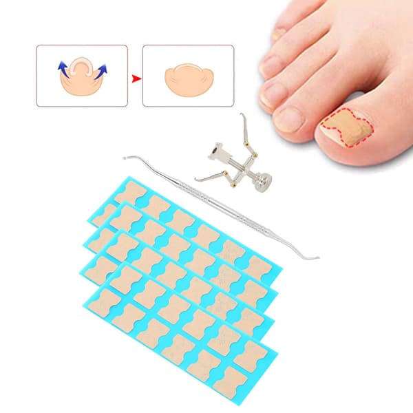 Ingrown Toenail Corrector Patch Ingrown Nail Corrector Cuticle Pusher Pedicure Tool 48 Pcs Patch