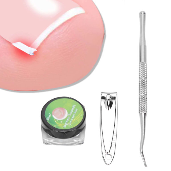 Bunion Corrector Kit Fotvård Inåtväxande tånagellyftare Pedikyr Straighten Clip Nagelsax #2