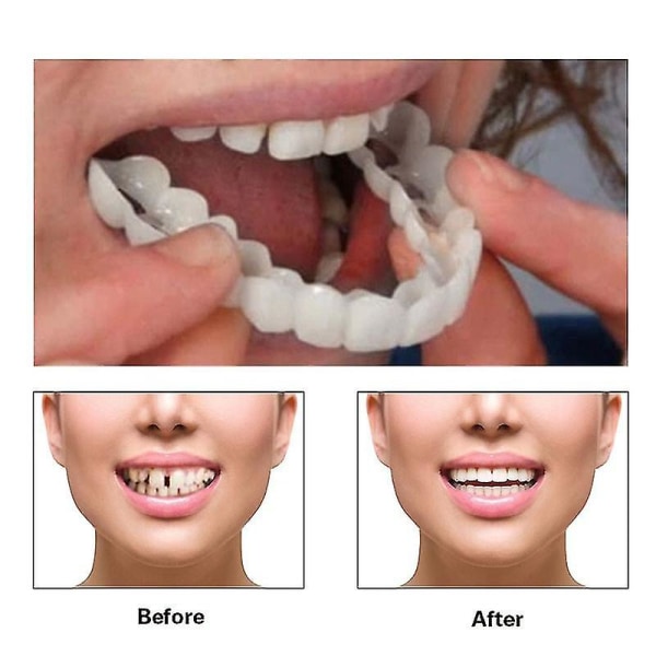 2 par instant finér proteser, kosmetiske finer tænder Top og bund Snap On proteser Clip i finer tænder