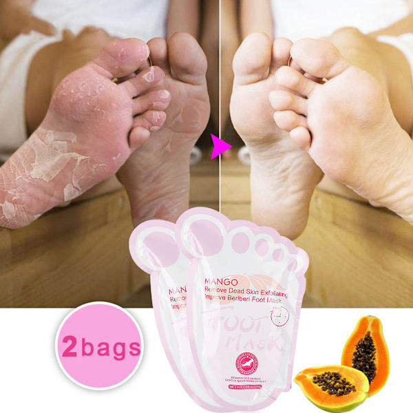 2 kpl / pussi Mango Foot Peel Mask Kuolleen ihon poisto Kynsinauhojen poisto Jalkavoiteen kuorinta