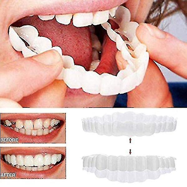 Seler Snap On øvre falske tænder Dental Finer Protese Cover Set
