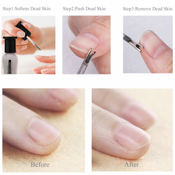 Nagelbandsskrapa i rostfritt stål, borttagare av död hud, nagelbandstång, manikyrpedikyrborttagningsverktyg för naglar och tånaglar