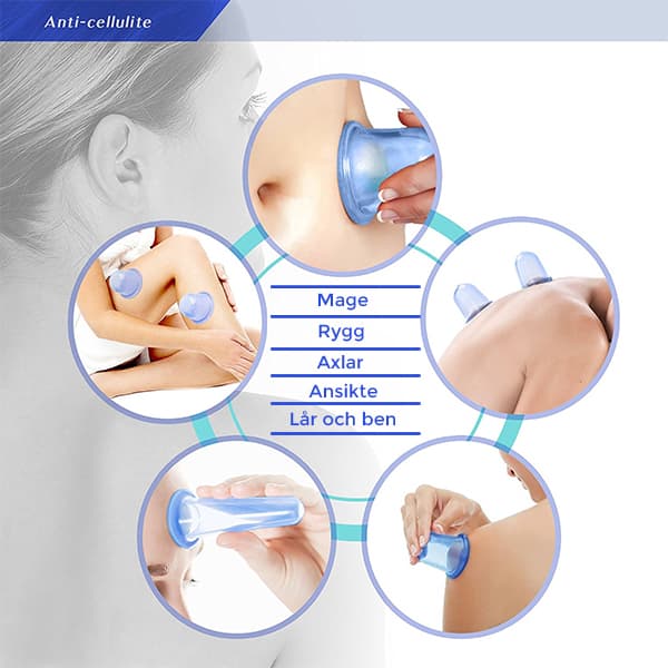 Koppning set 4 pack - Vakuumkoppar för massage / cellulitbehandling