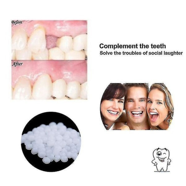 10g/100g tand- och rymdprotes fast lim hartsprotes vidhäftande tandläkare tandprotes fast lim temporärt tandrestaureringssats (50g)
