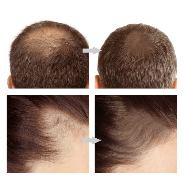 Hårskugga hårrots-touch-up, cover tunnare hår på några sekunder, Root Concealer döljer omedelbart håravfall för en naturlig look（Mediumbrunt）