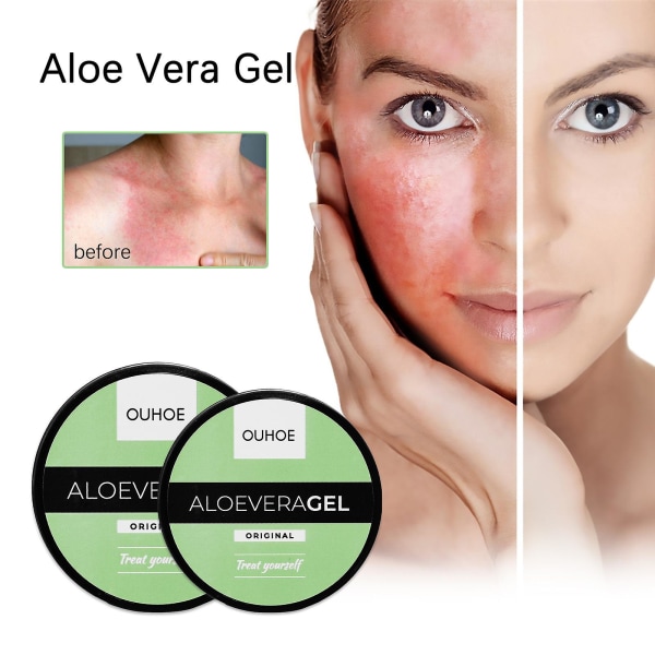 Tanning Aid Cream Aloe Vera Gel Summer Beach Tanning Aid Solskyddsmedel Brons Skin Sunburn Repair Gel Aloe Vera Gel - 50g