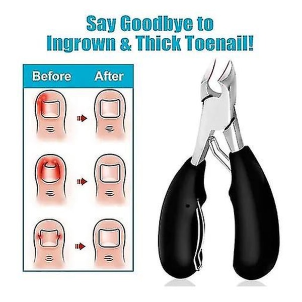 Bezox tåneglesaks, neglesaks trimmer til tykke eller indgroede tånegle, fingerneglesaks kirurgisk stål - med metalopbevaringsboks