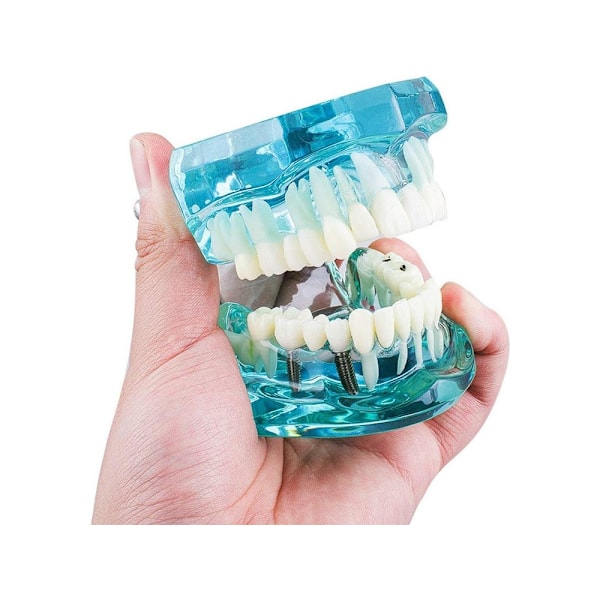 Anatomisk Tandmodell - Tandprotes Blue